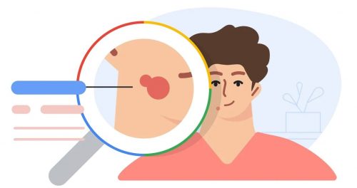 أداة جديدة من Google تقوم بتشخيص الأمراض الجلدية بطريقة تفاعلية